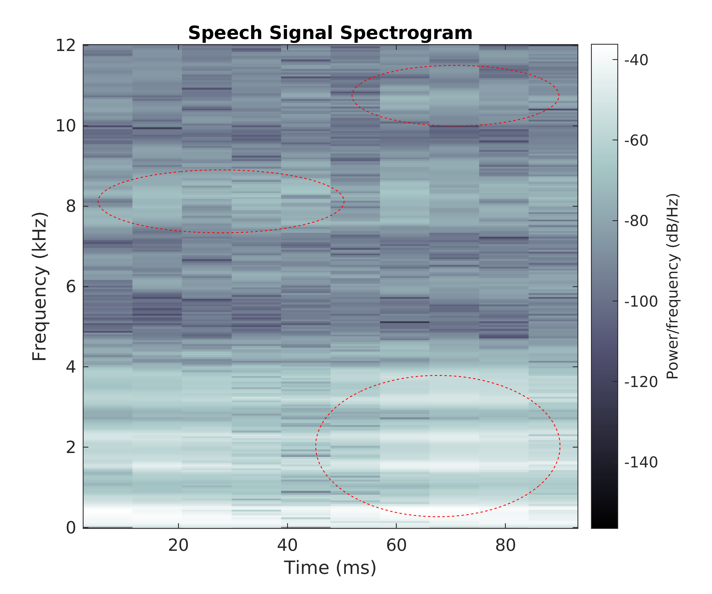 Spectrogram